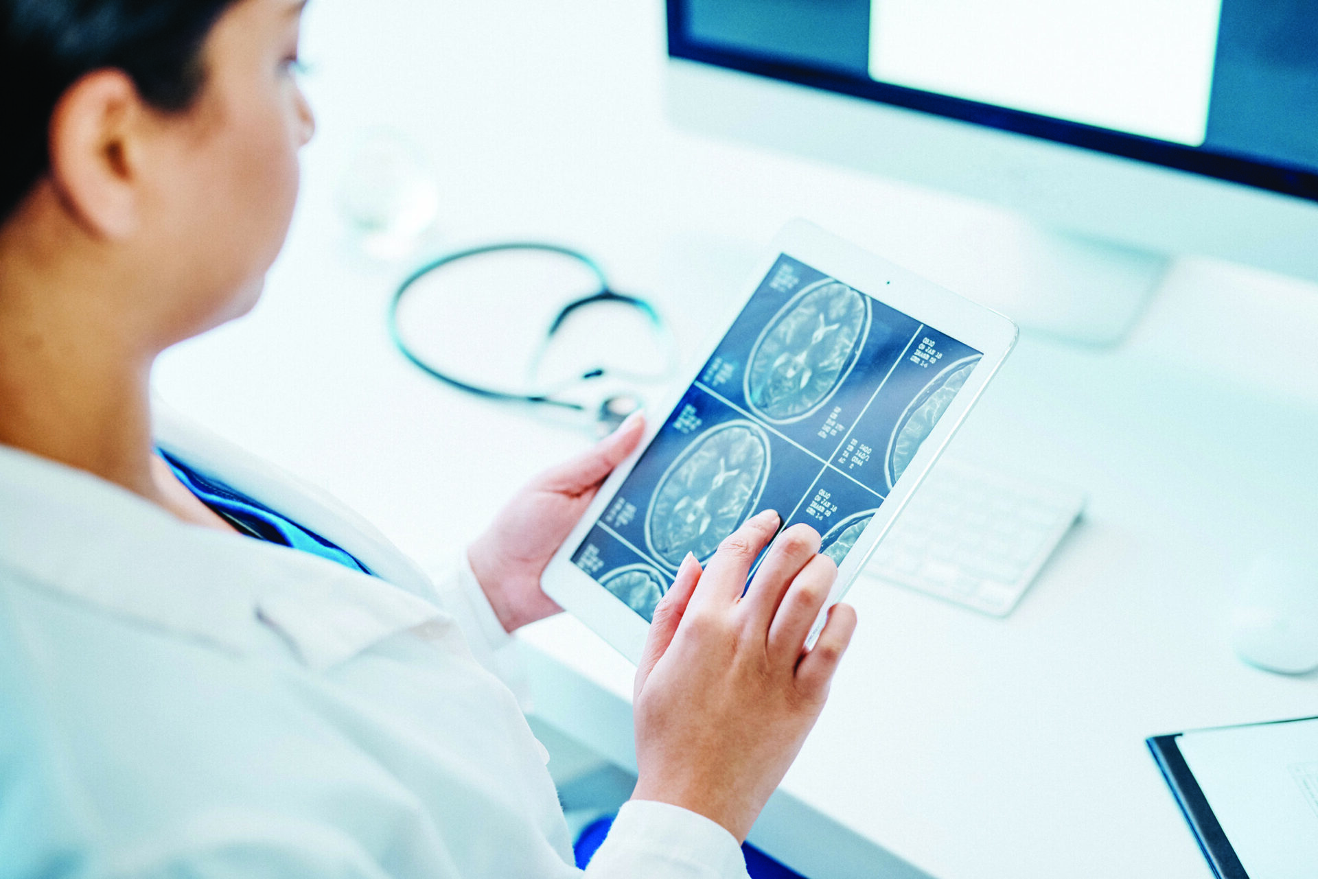 Doctor reviewing an MRI on an ipad